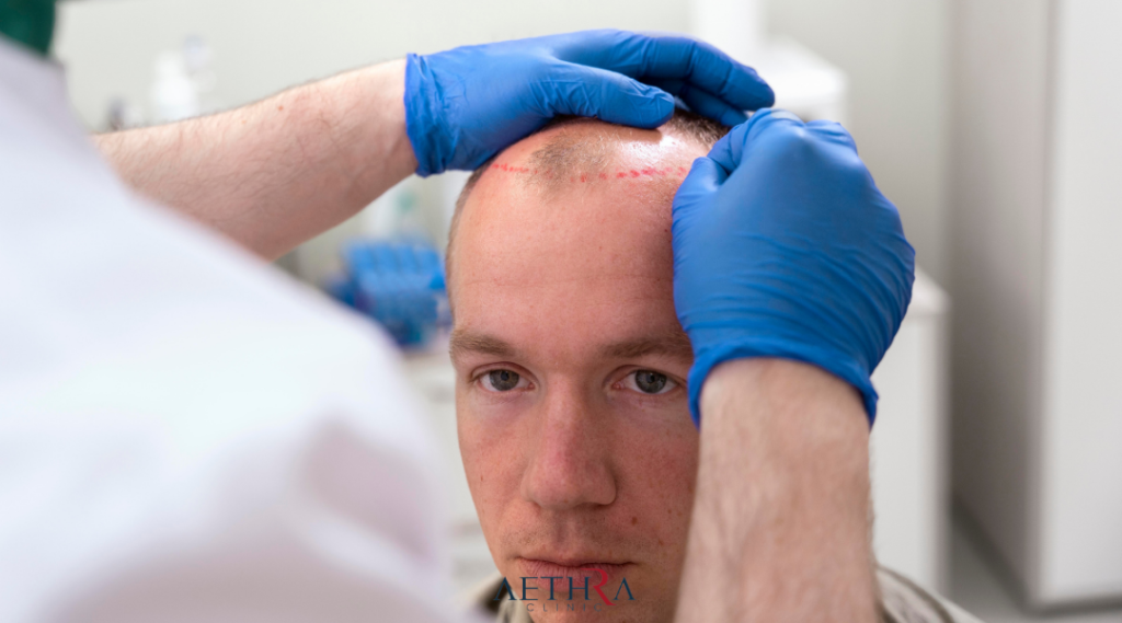 Why the Hairline Is So Important